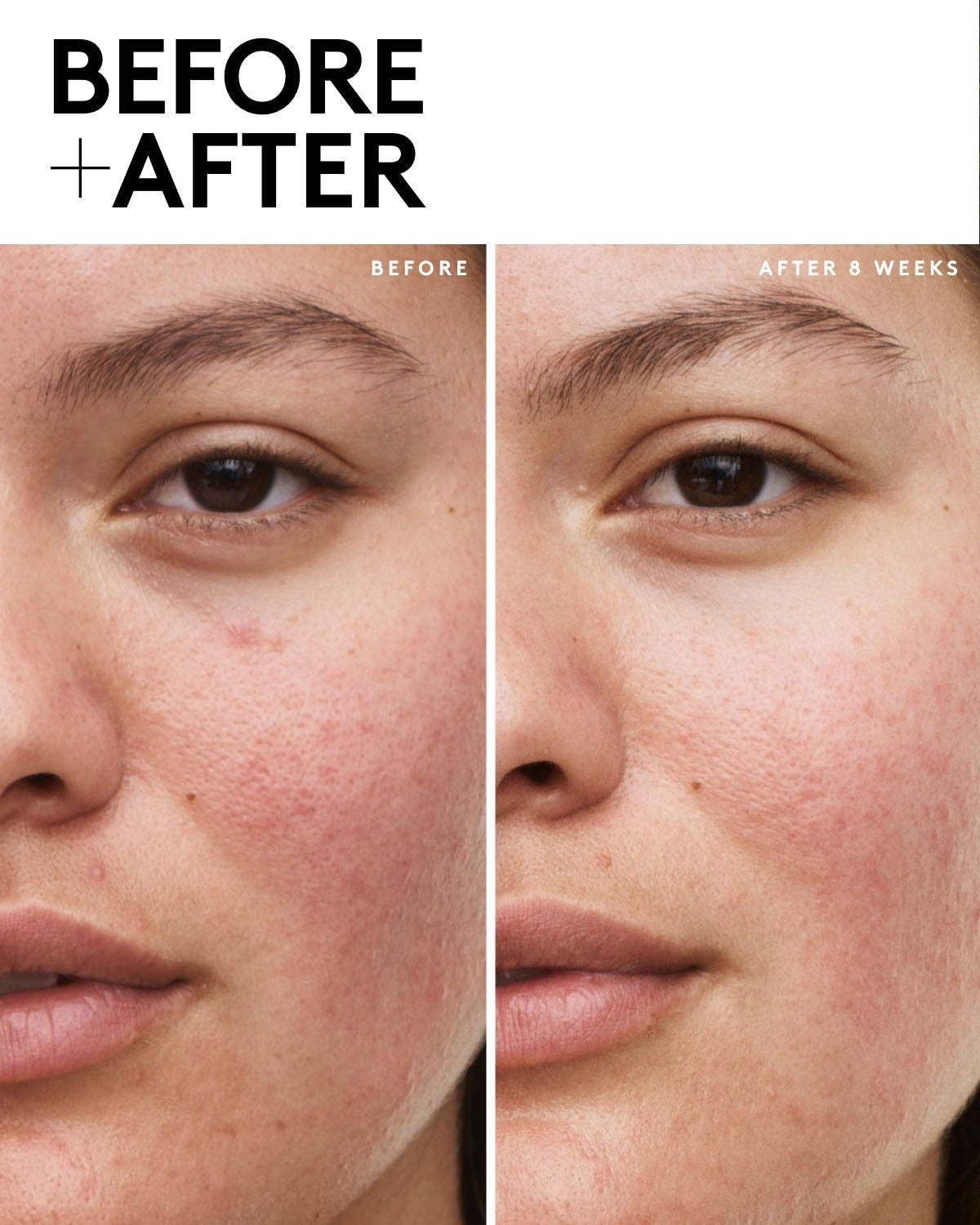 Daily Brightening UV Defense SPF 30