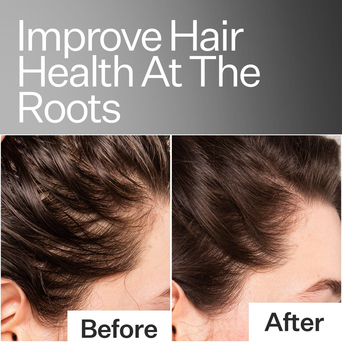 Scalp Relief System