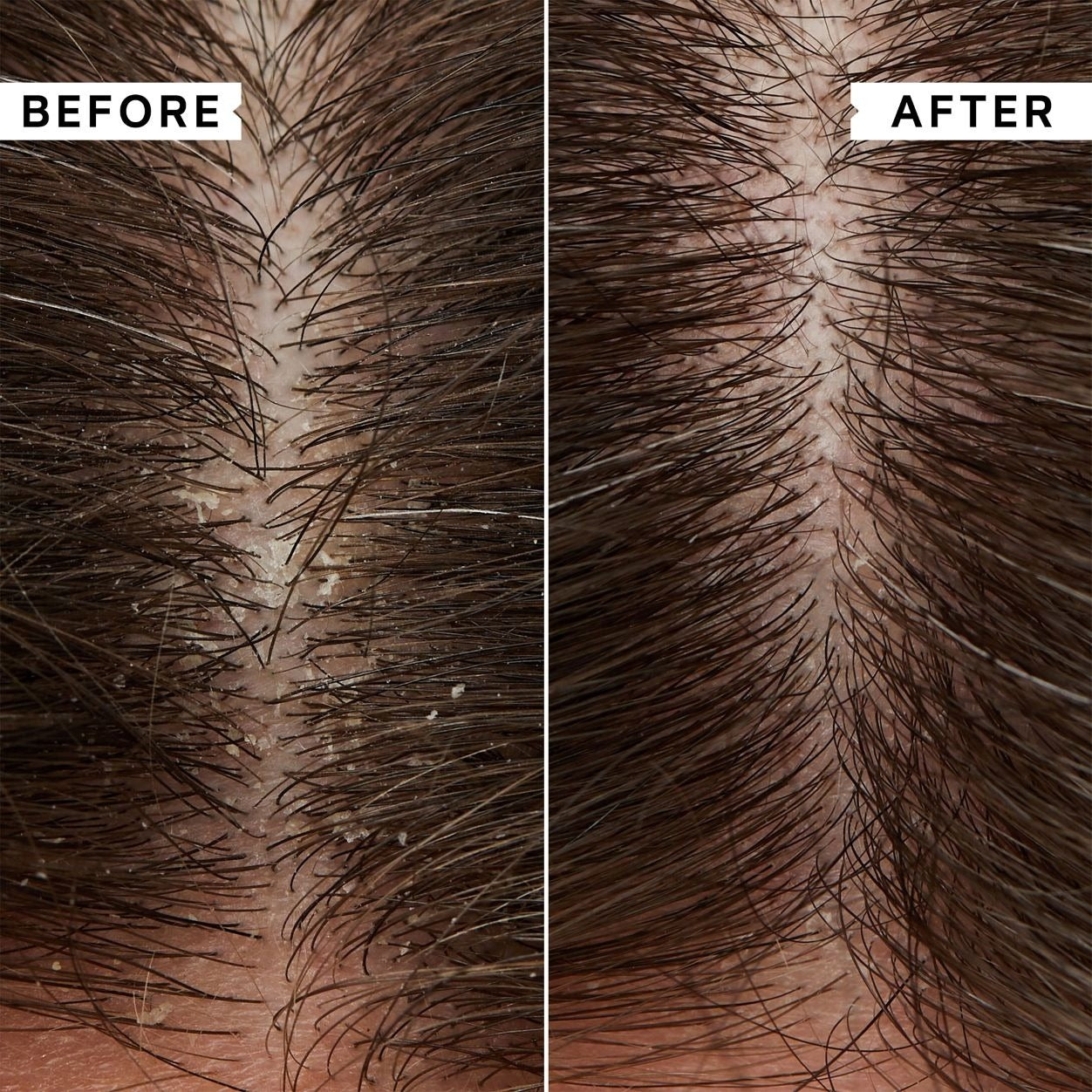 Flaky Scalp Hydrating Conditioner