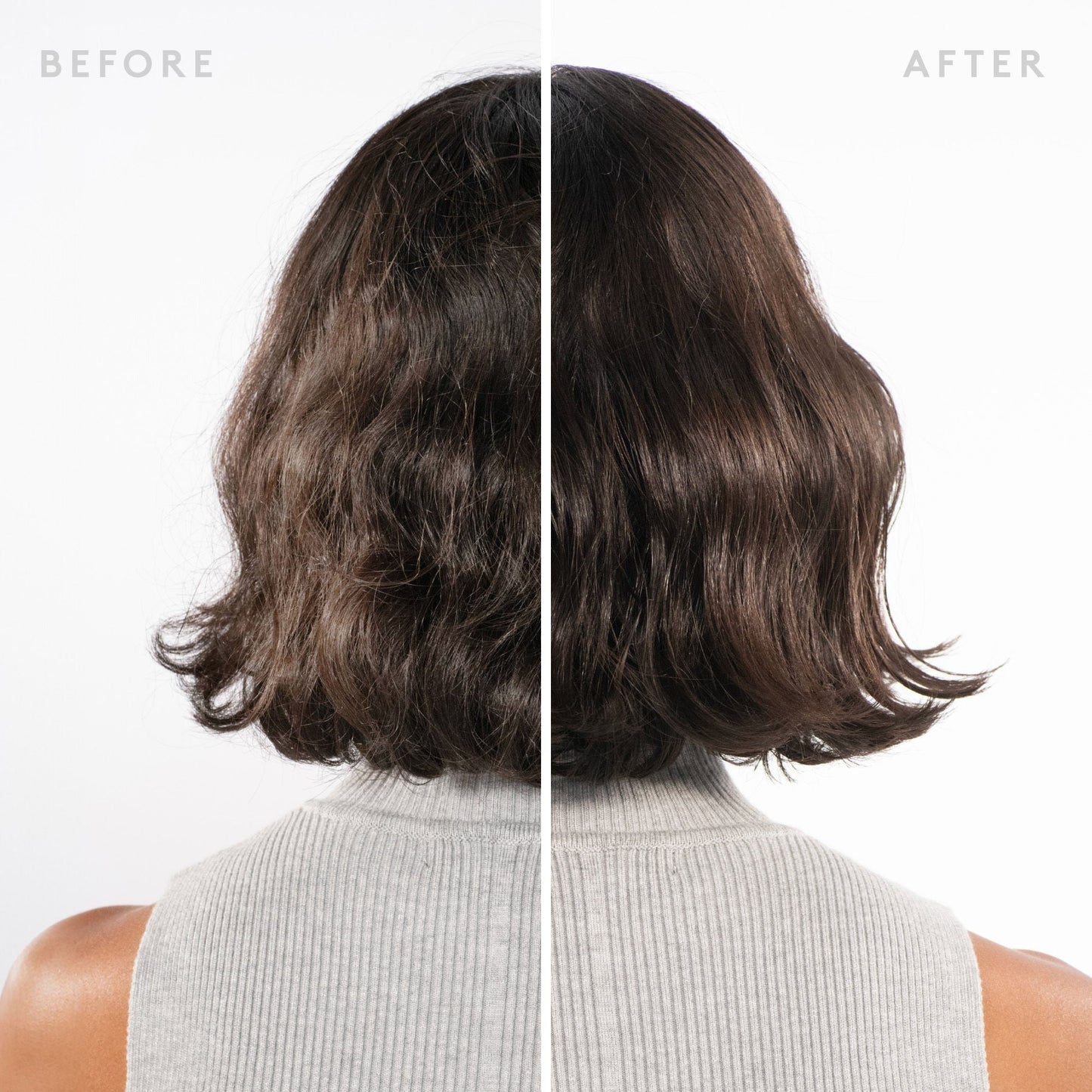 Scalp Remedy Shampoo for Scalp and Hair Health