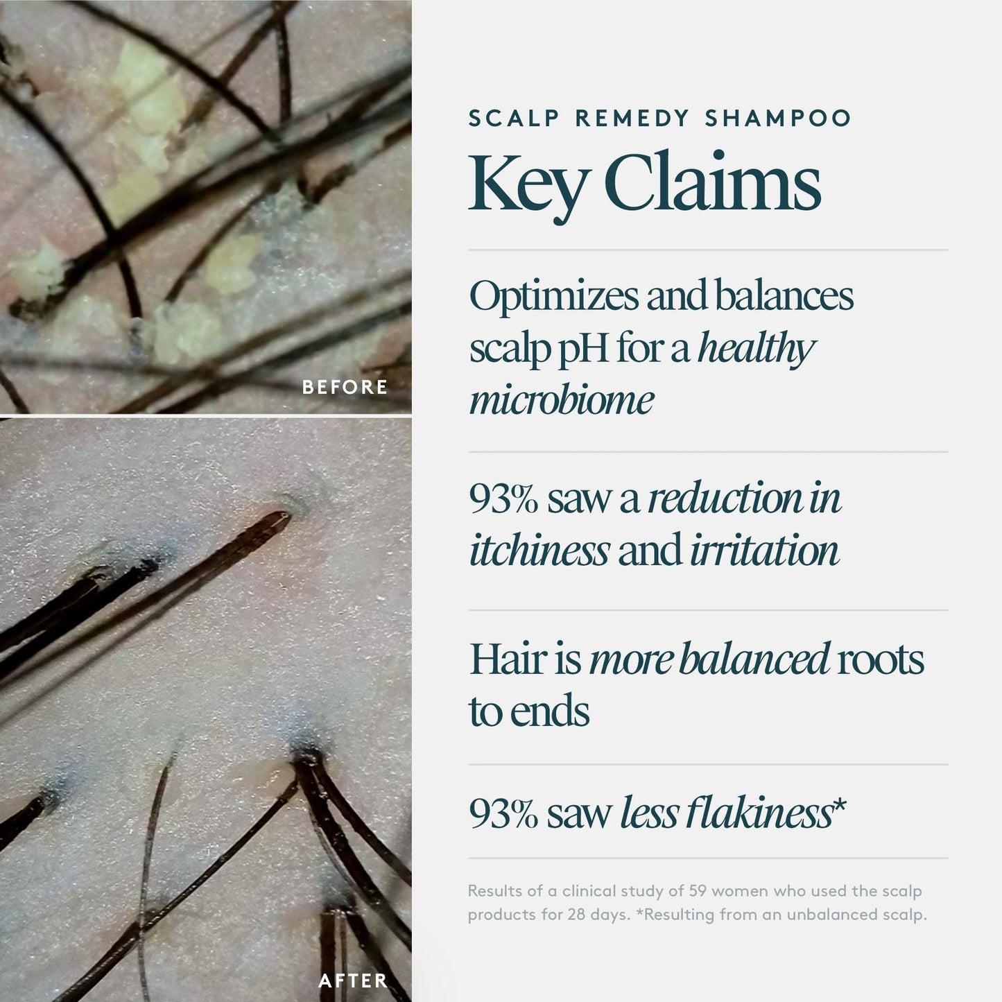 Scalp Remedy Shampoo for Scalp and Hair Health