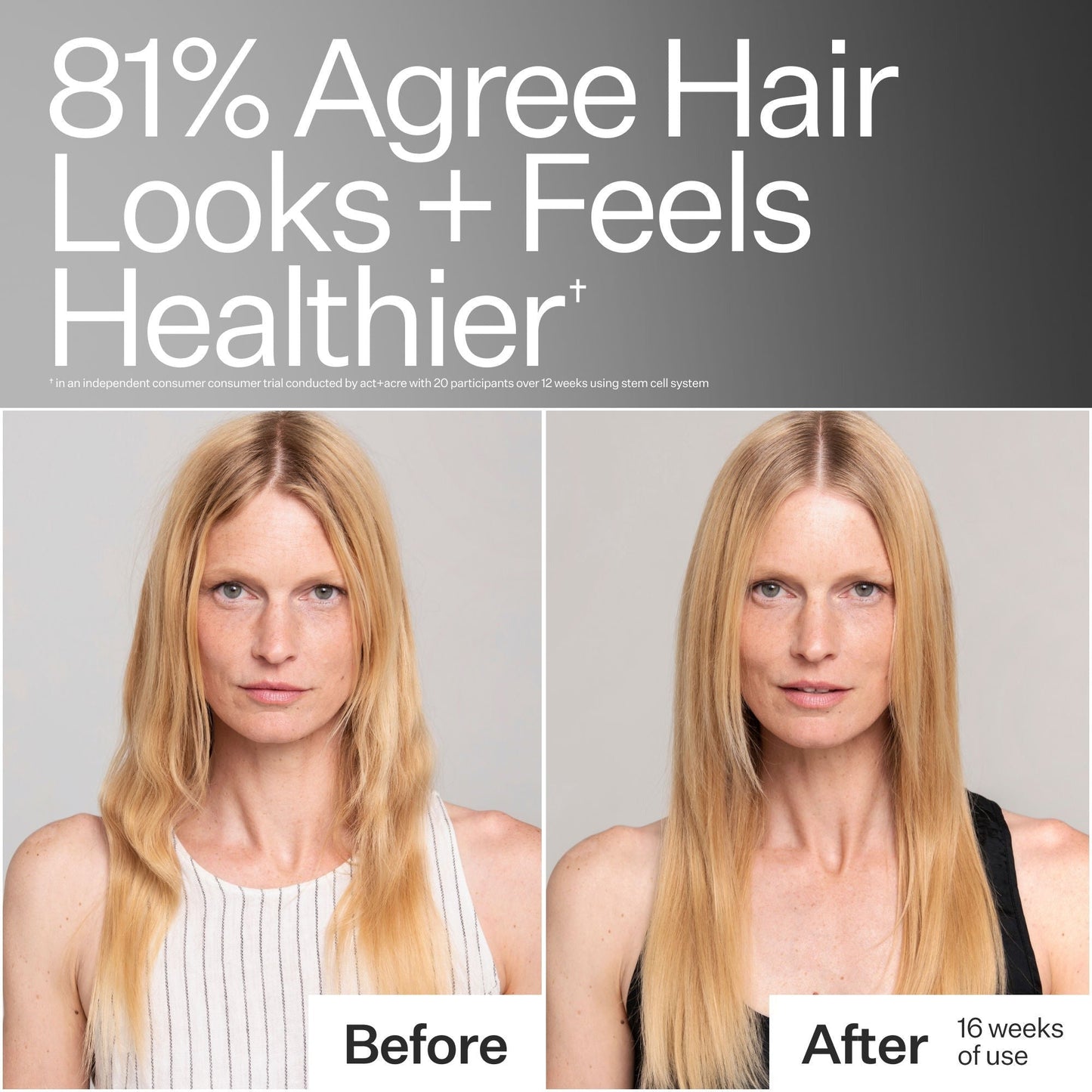 Stem Cell Conditioner For Thicker Fuller-Looking Hair