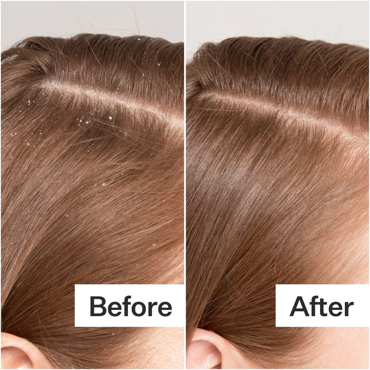 Cold Processed Scalp Detox