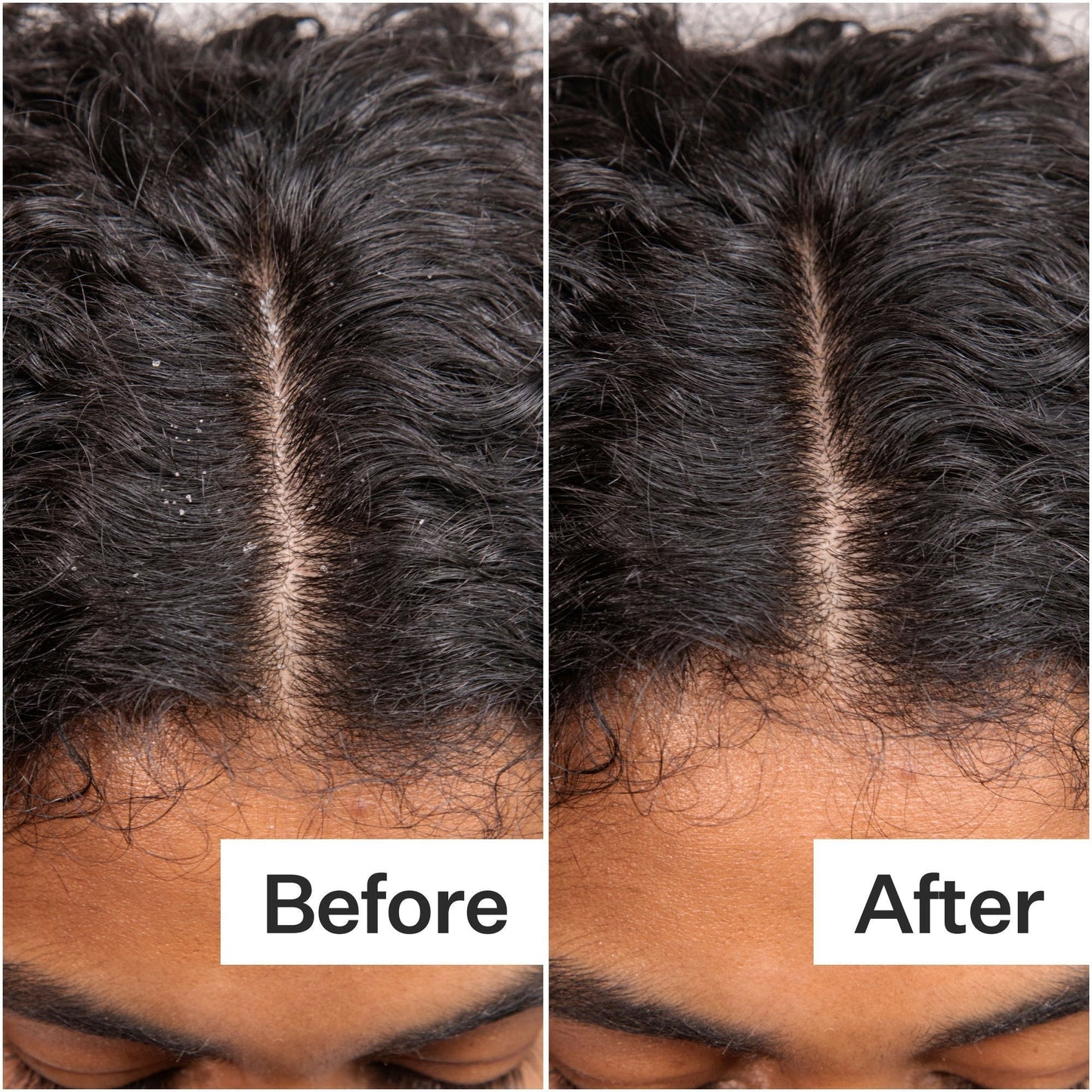 Daily Hydro Scalp Serum with Hyaluronic Acid for Dry Scalp