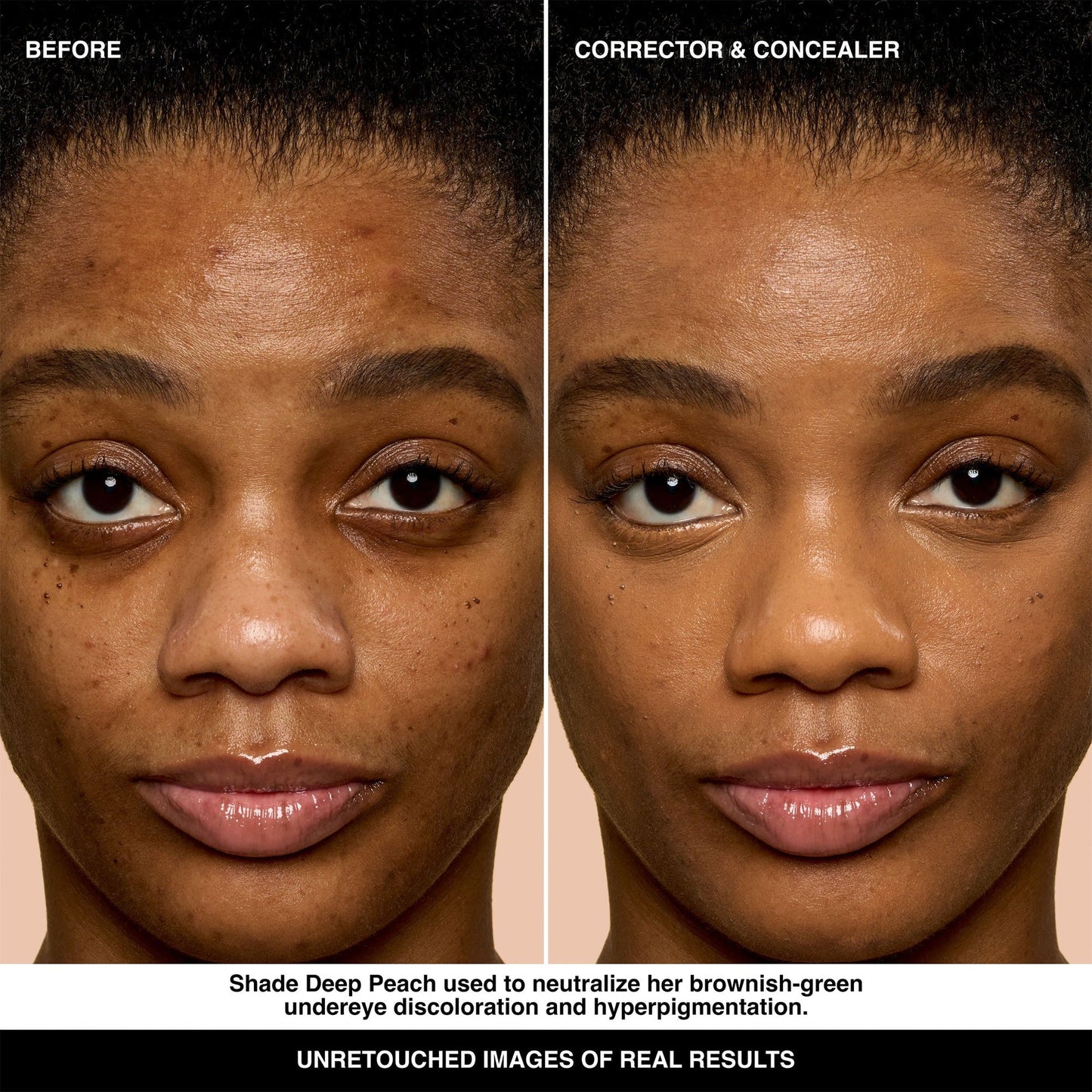 Skin Corrector Stick