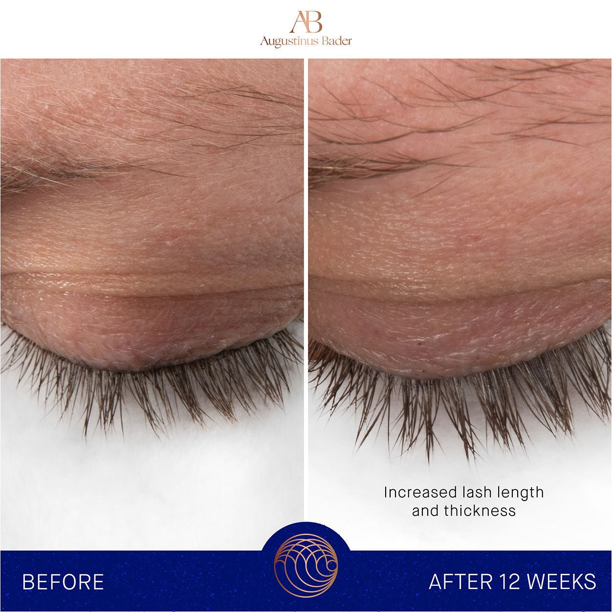 The Eyebrow and Lash Enhancing Serum