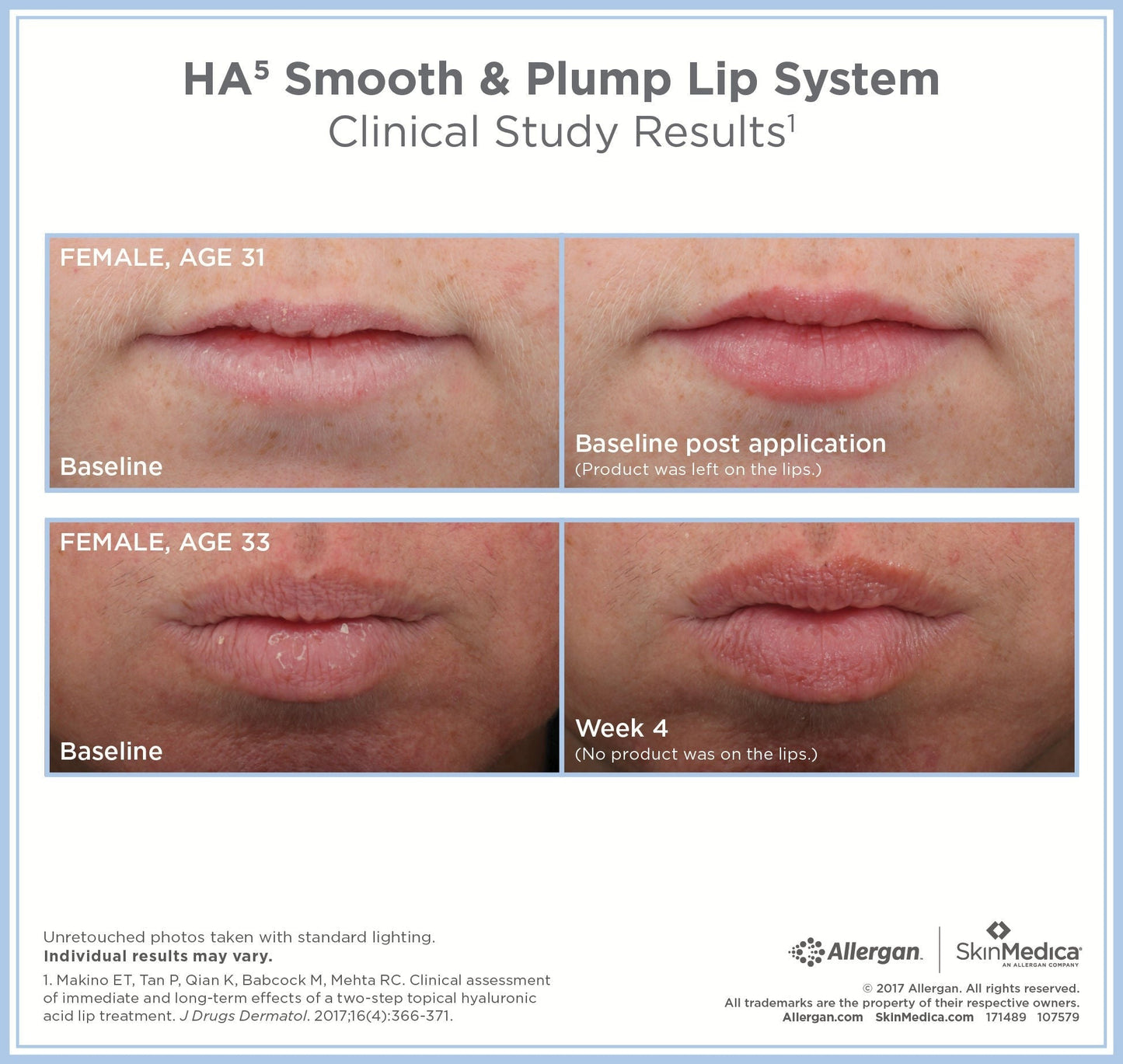 HA5 Smooth and Plump Lip System