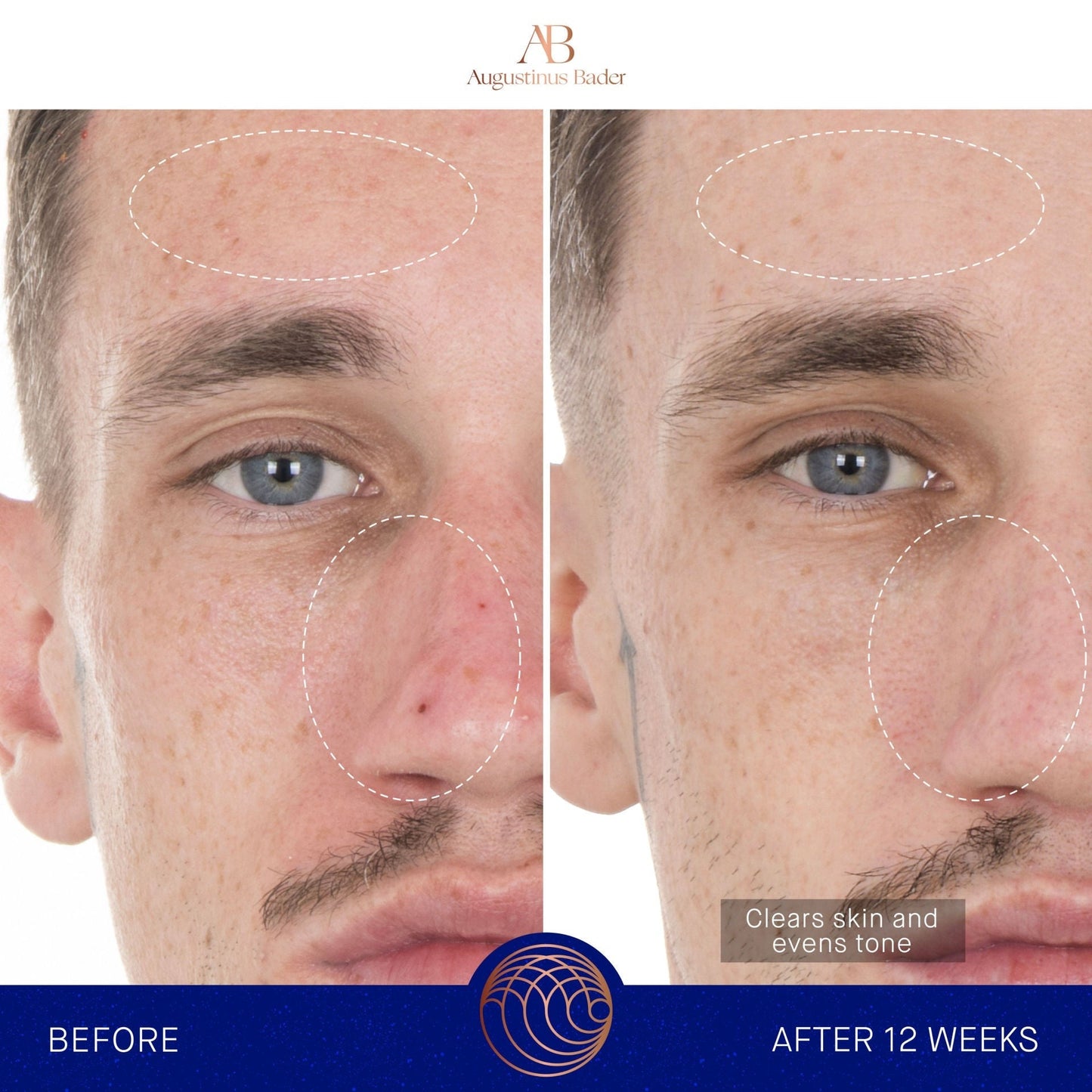 The Retinol Serum