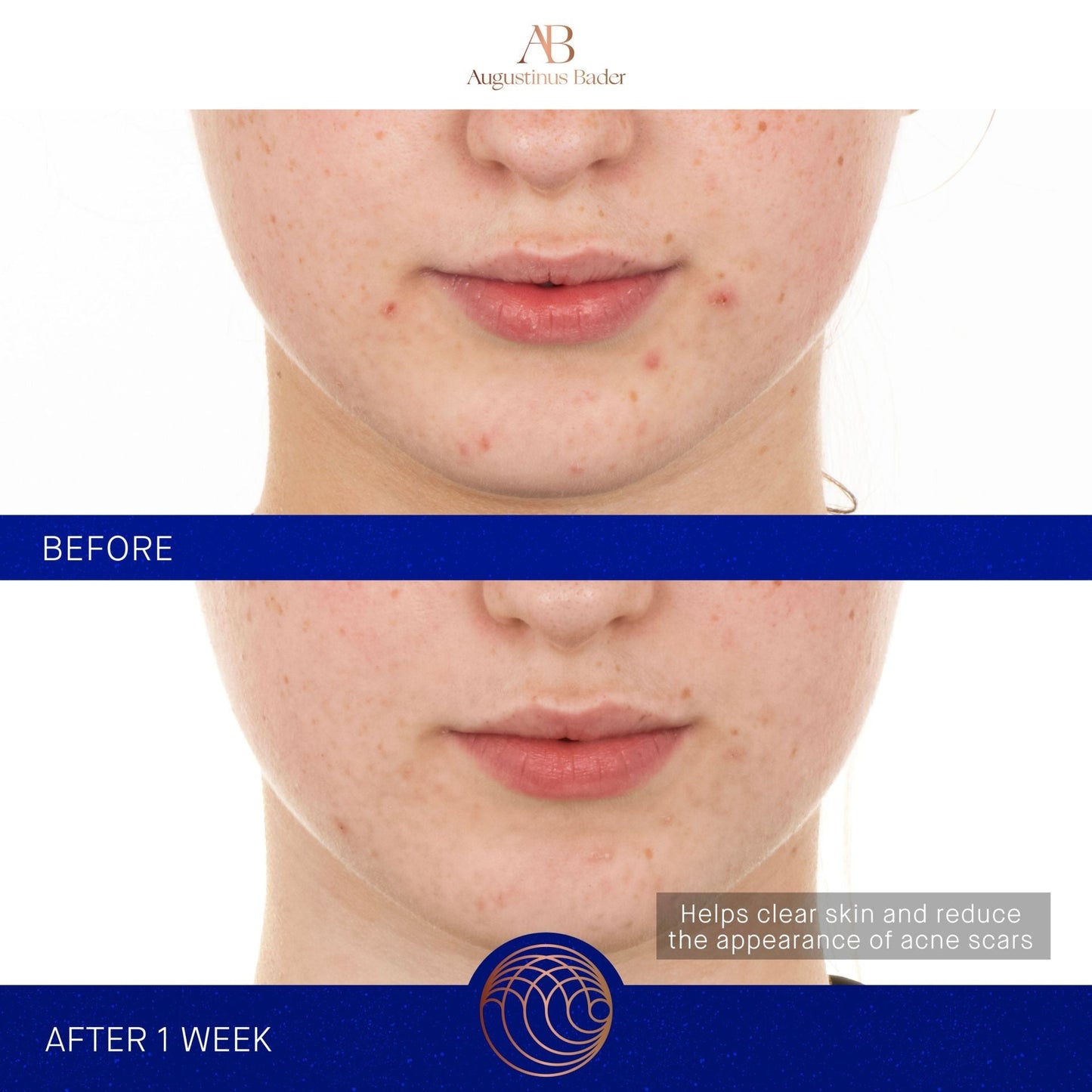 The Retinol Serum
