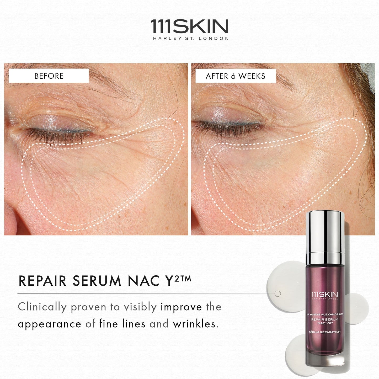 Repair Serum NAC Y2