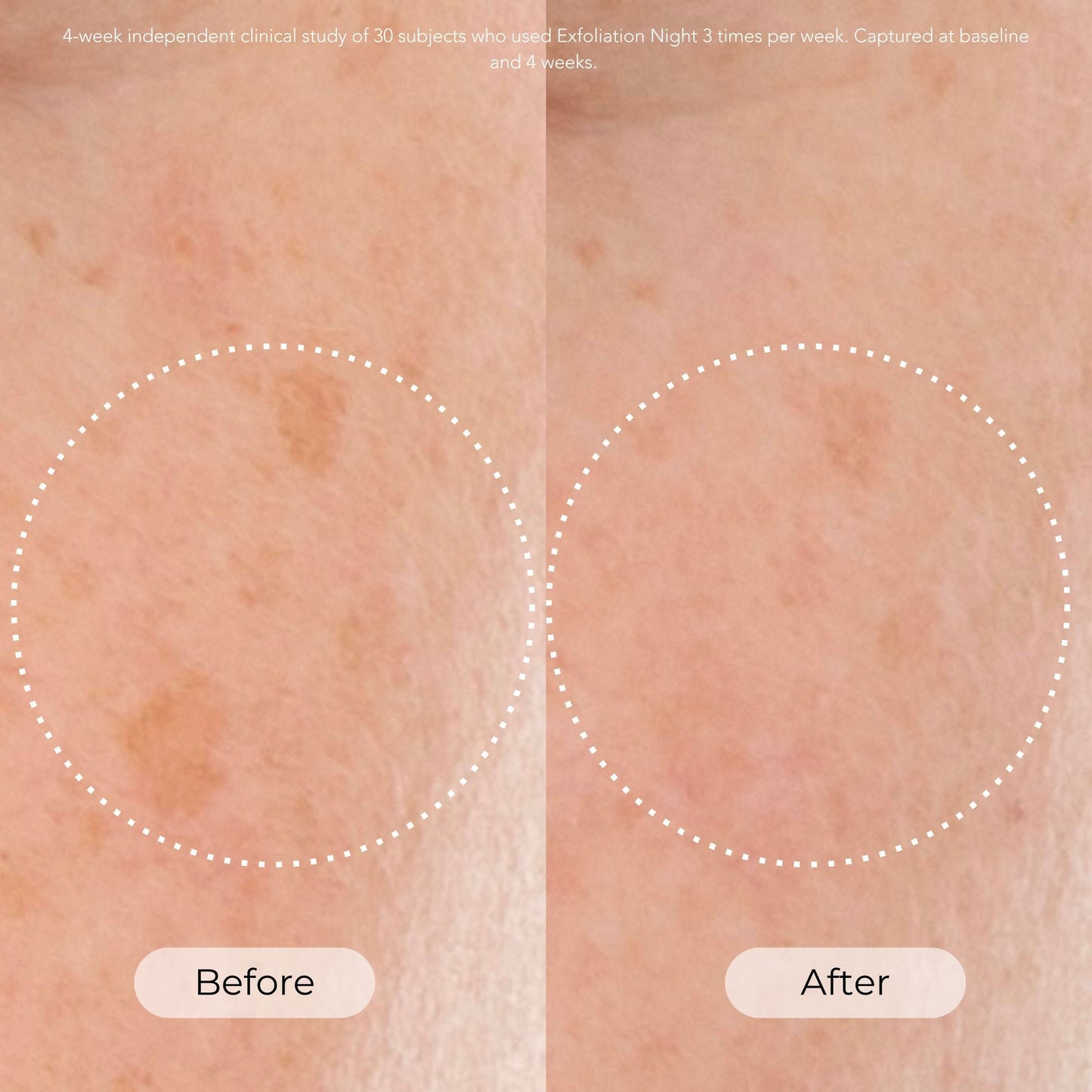 Exfoliation Night Resurfacing and Brightening Serum