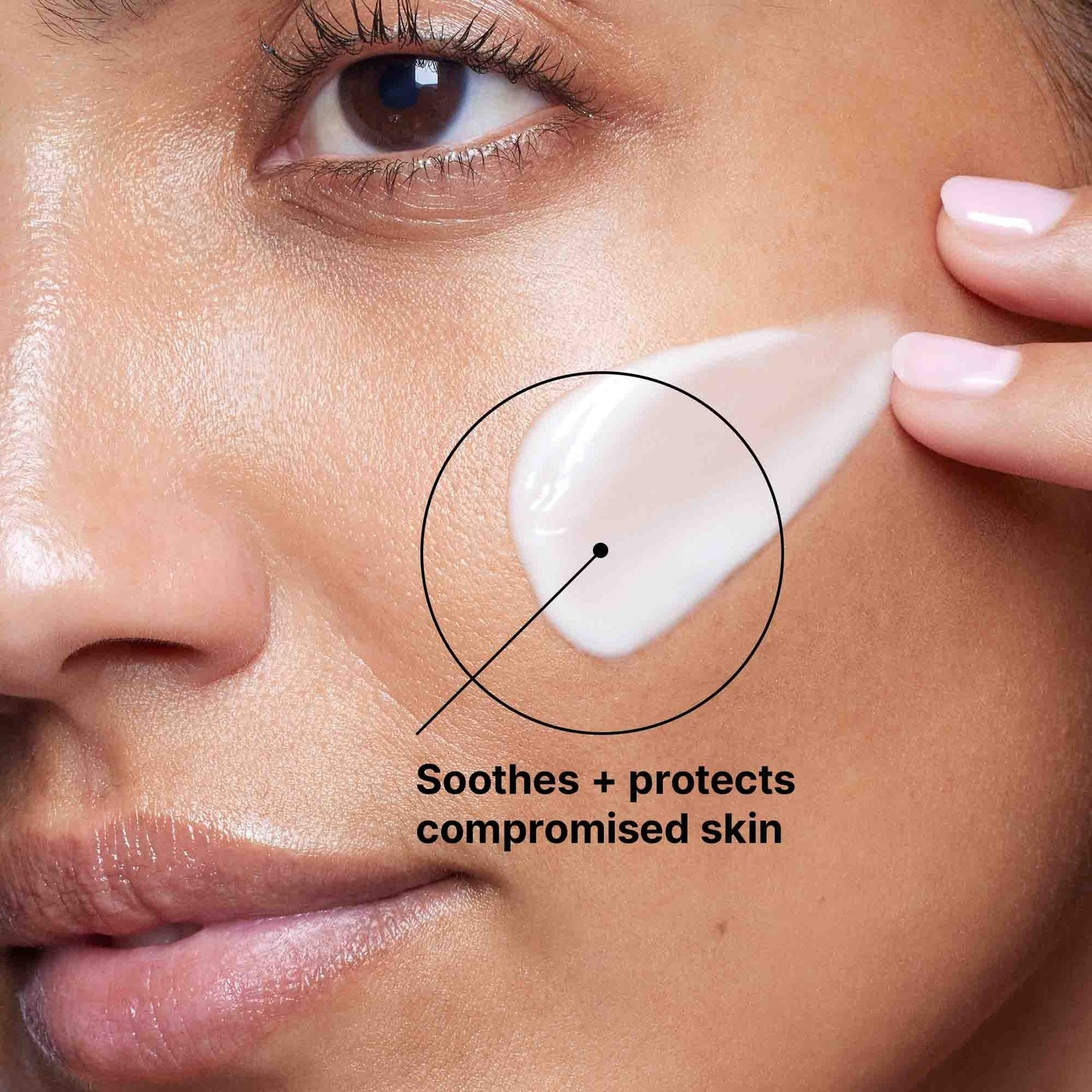 Epidermal Repair