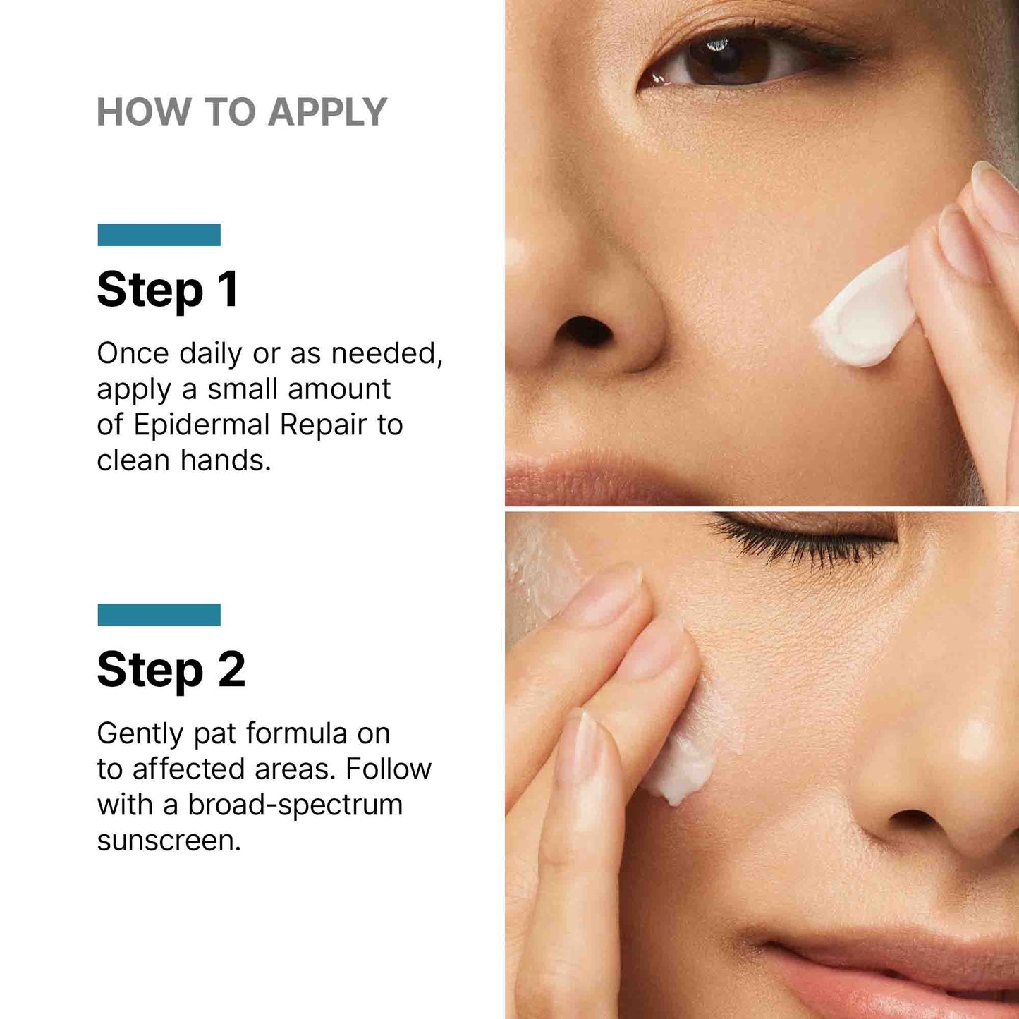 Epidermal Repair