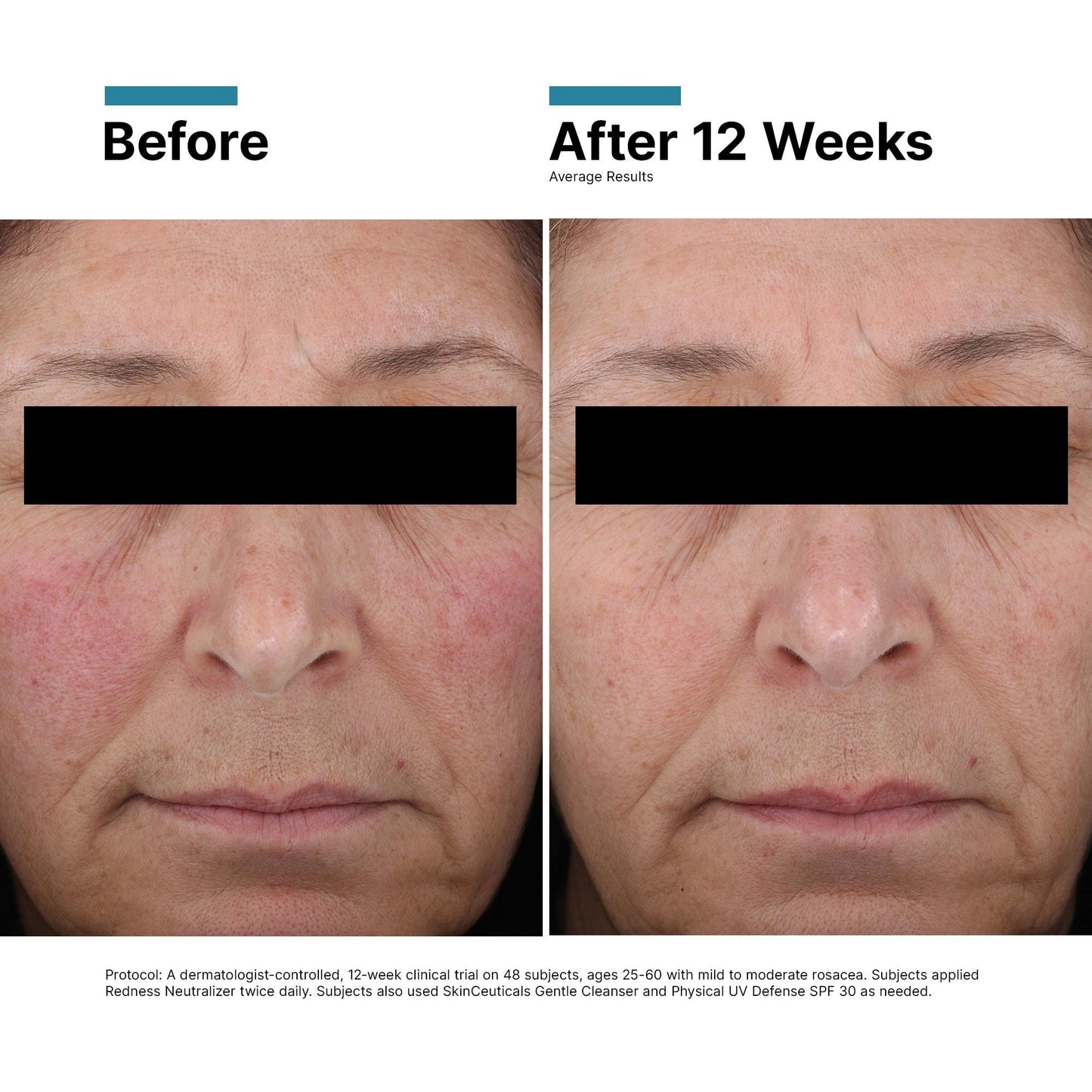 Redness Neutralizer