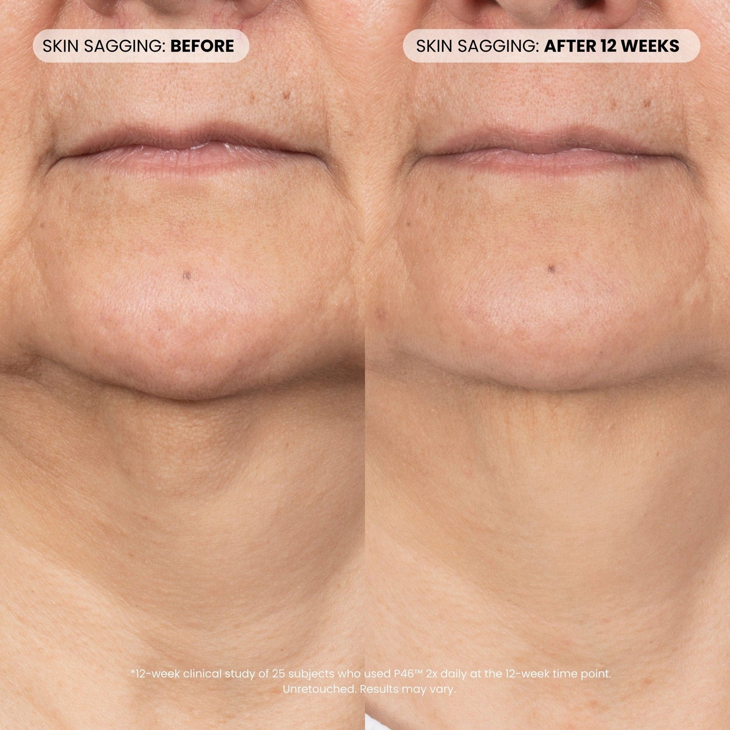 P46 Peptide + HA Plumping Serum