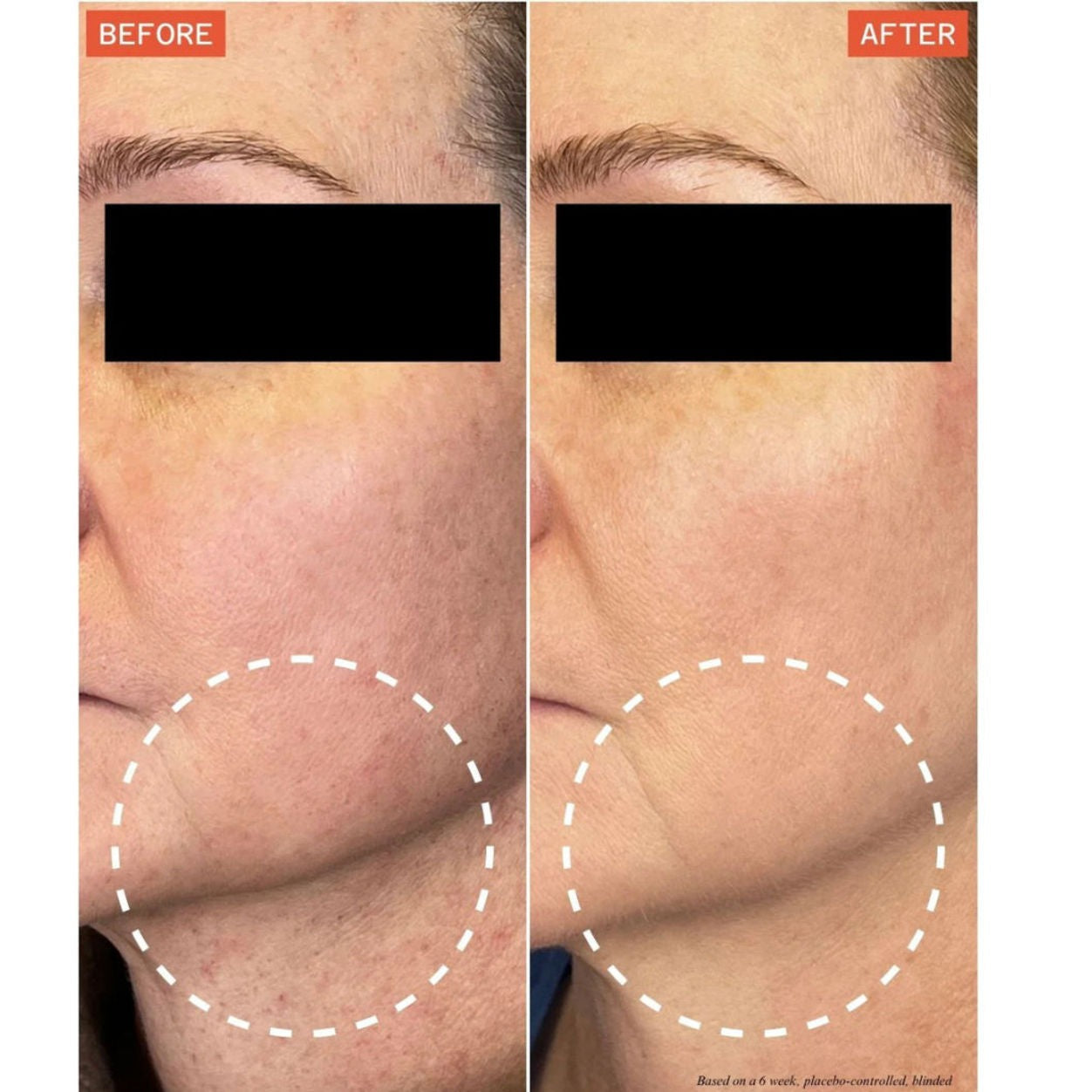 DermaReverse