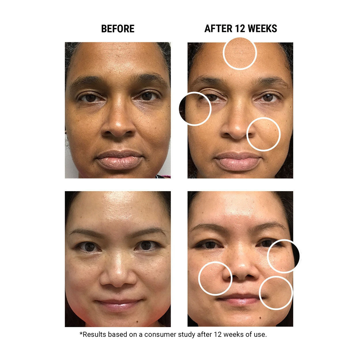 Micro-Dose Anti-Aging Retinol Serum With Ceramides and Peptide