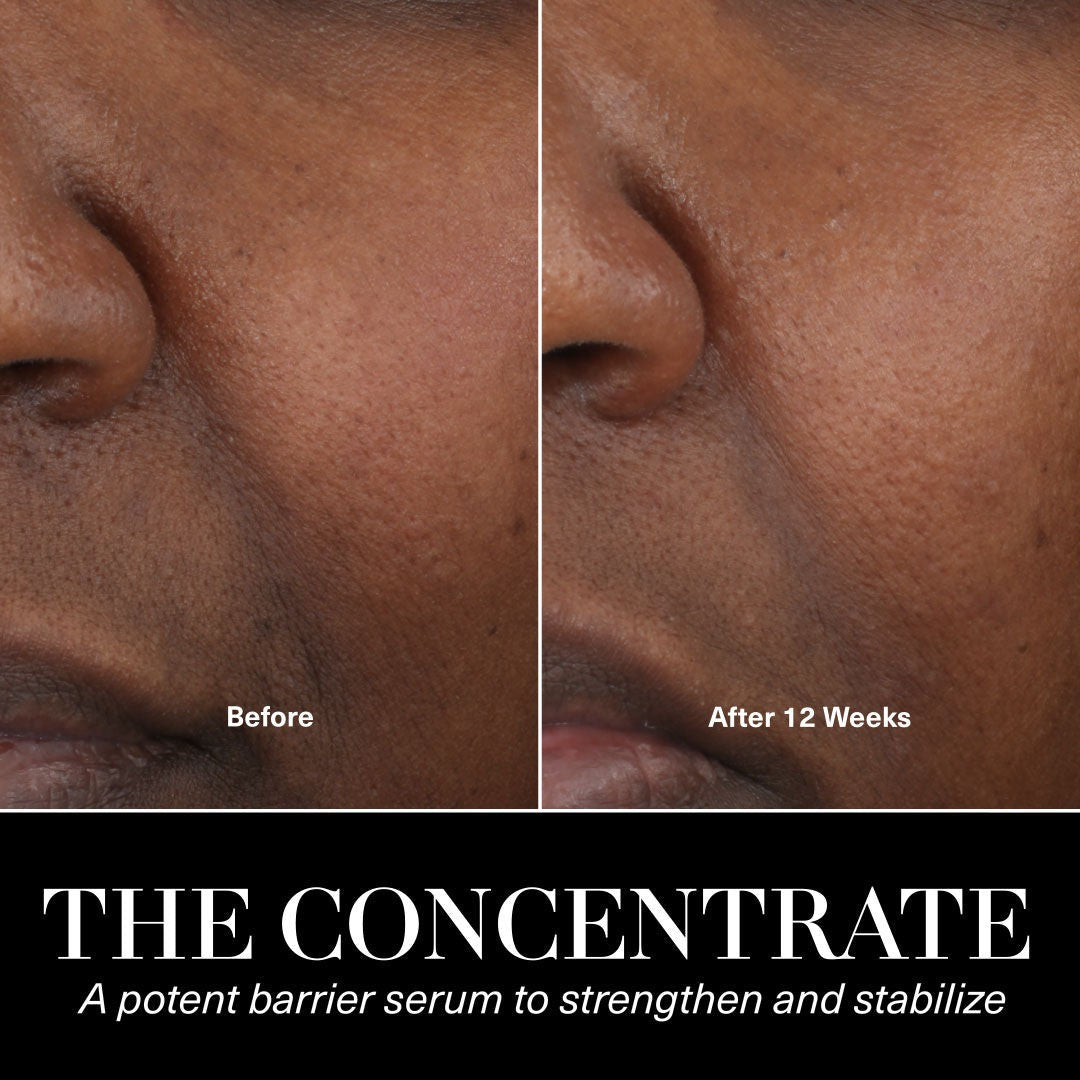 The Concentrate