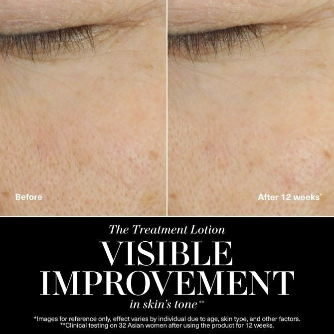 The Treatment Lotion