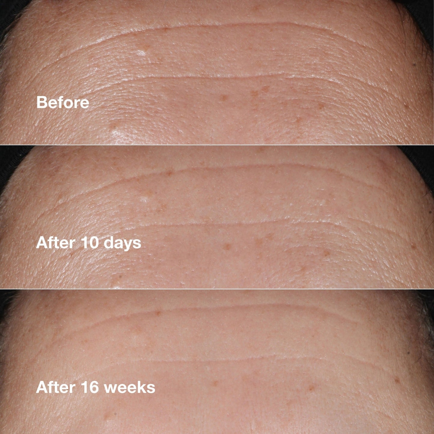 Smart Clinical Repair Wrinkle Correcting Serum