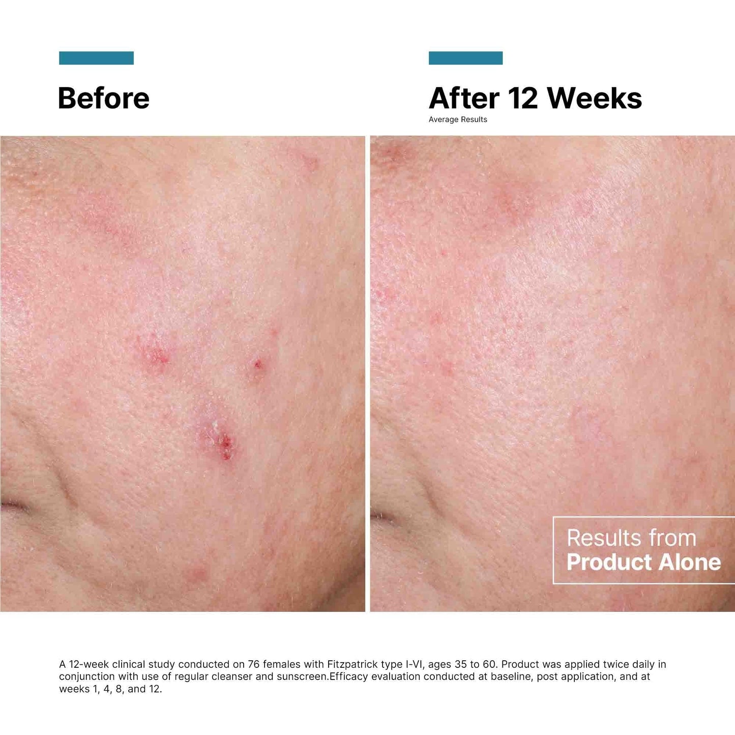 Advanced RGN-6 Regenerative Cream