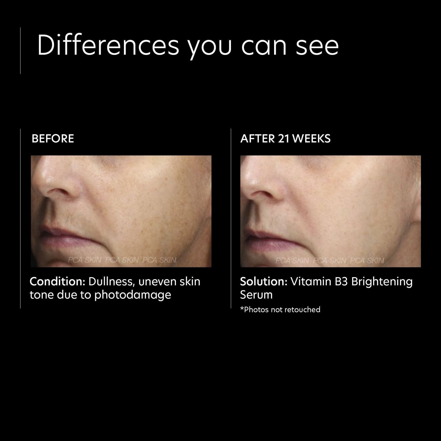 Vitamin B3 Brightening Serum