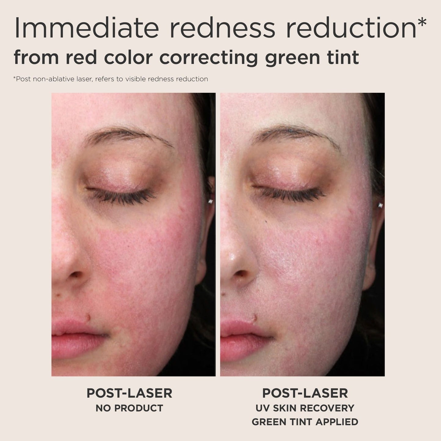 UV Skin Recovery Red Color Correcting Green Tint Broad Spectrum SPF 50